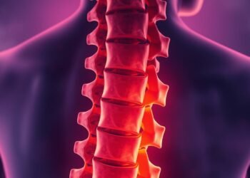 Bandscheibenvorfall Diagnose