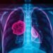 Lungenkrebs Diagnose